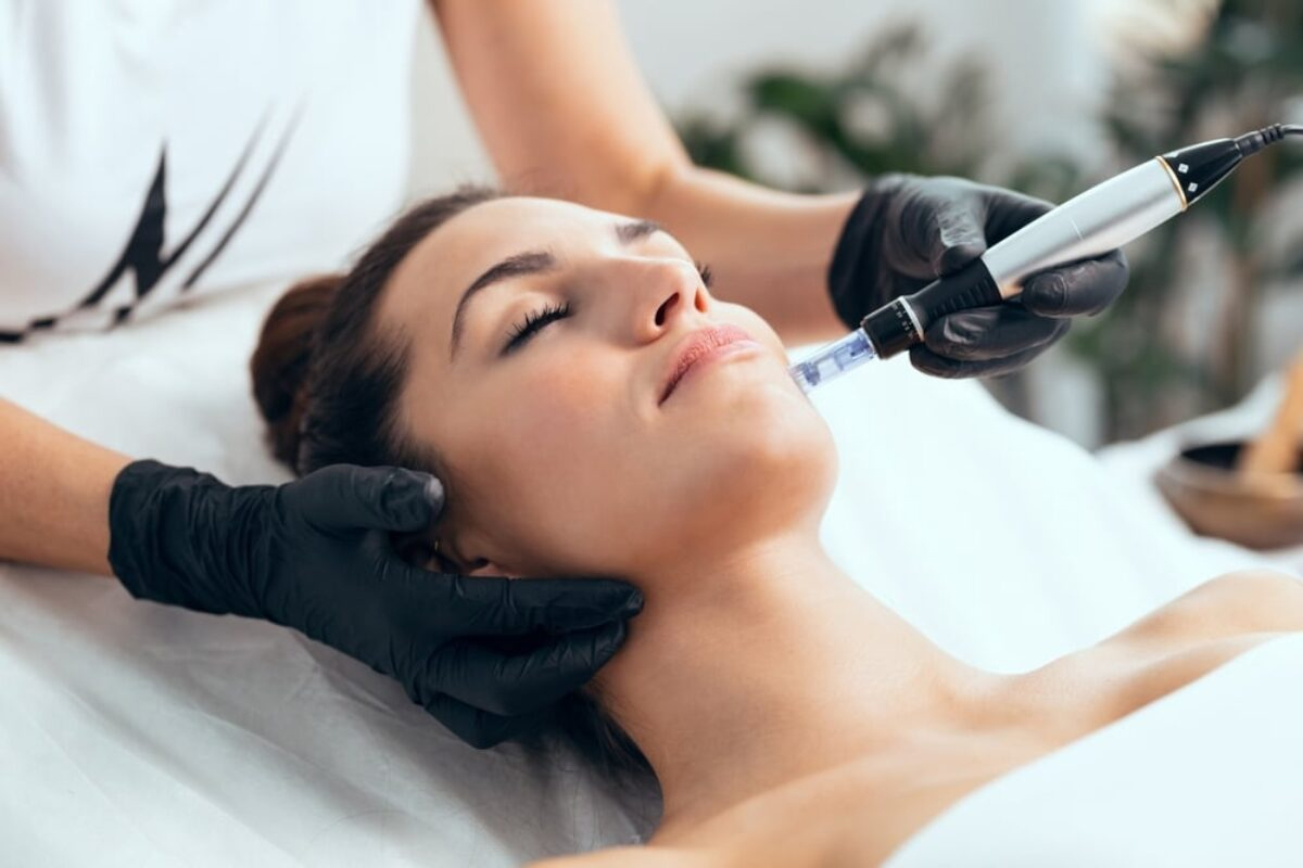 Indications for Microneedling with PRF