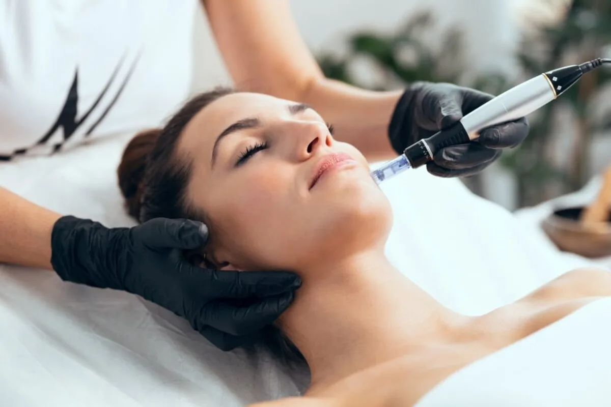 Indications for Microneedling with PRF