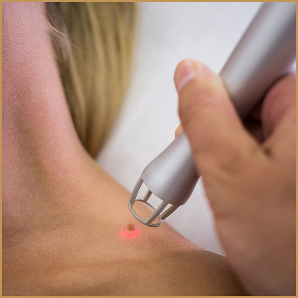 How-Our-Neuromodulators-Therapy-Works